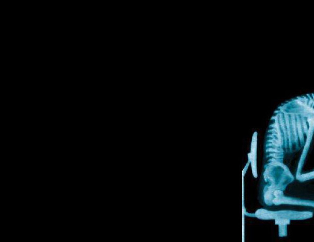 x-ray-posture
